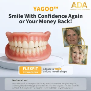 🌎Ends Today: 40% OFF! YAGOO™ Custom-Fit Full Functional DenturesMake you more confident