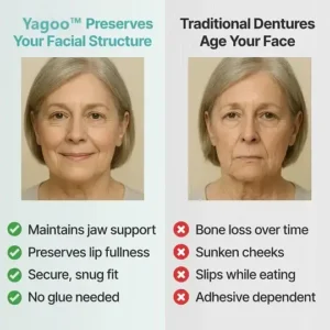 Yagoo™ Custom Custom-Fit Full Functional Dentures
