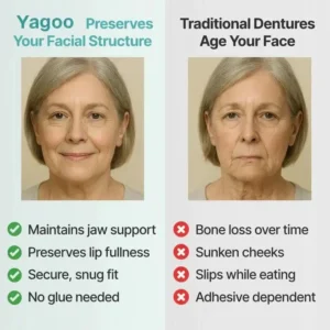 Yagoo™ Medical Full Denture with Strong Suctiond