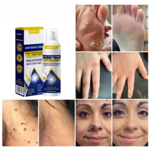 Yagoo® Chillique Bump Renewal Spray