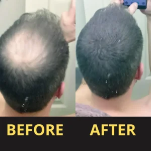 Yagoo Hair Concealer 50ML - Waterproof 3–7 days.