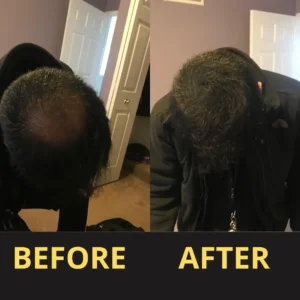 Yagoo Hair Concealer 50ML - Waterproof 3–7 days.