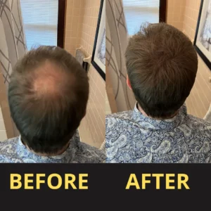 Yagoo Hair Concealer 50ML - Waterproof 3–7 days.