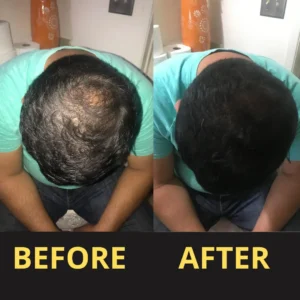 Yagoo Hair Concealer 50ML - Waterproof 3–7 days.