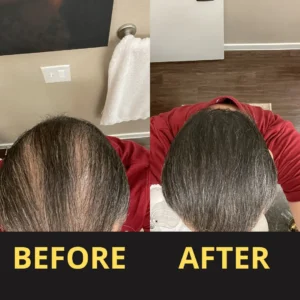 Yagoo Hair Concealer 50ML - Waterproof 3–7 days.