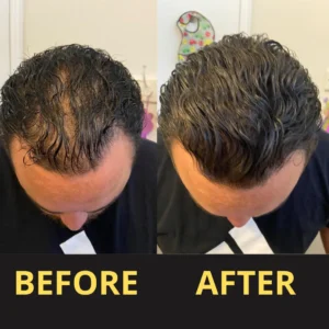 Yagoo Hair Concealer 50ML - Waterproof 3–7 days.