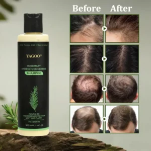 🌱 LAST DAY 50% OFF-Yagoo® Rosemary Hydrolyzed Shampoo , Unlock the Secret to Thicker, Healthier-Looking Hair