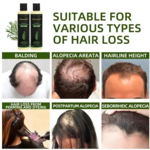 🌱 Yagoo® Hair growth shampoo , Unlock the Secret to Thicker, Healthier-Looking Hair