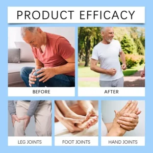 🔥Instant Pain Relief🔥 YAGOO™ joint Relief Gel – Natural Herbal Ointment Wellness