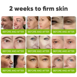 🧠👨‍⚕️Made and shipped from the USA 💫Yagoo® Skin Tightening & Vita-A Retinol Retinol shot Anti-Wrinkle Firming Tightening cream - Last Day Promotion 70% OFF