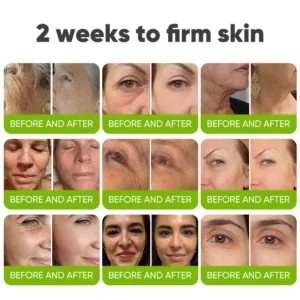 🧠👨‍⚕️Made and shipped from the USA 💫Yagoo® Skin Tightening & Vita-A Retinol Retinol shot Anti-Wrinkle Firming Tightening cream - Last Day Promotion 70% OFF