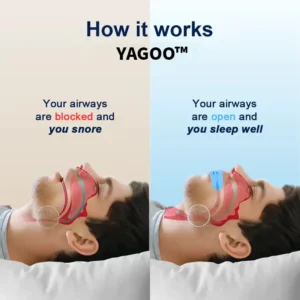 Yagoo®  Professional intelligent anti-snoring device