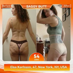 💞Yagoo™ 4-in-1 Shaping and Fat-Burning Microfiber Shorts