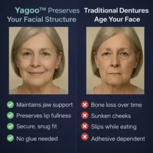 2026🏆✨LAST DAY SALE 60% OFF🔥 Newly upgraded second-generation Yagoo™ complete dentures
