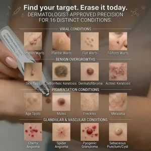YAGOO® 7-Day Skin Tag & Spot Eraser Painless & Scar-Free Advanced Imperfection Removal Rollerball Pen